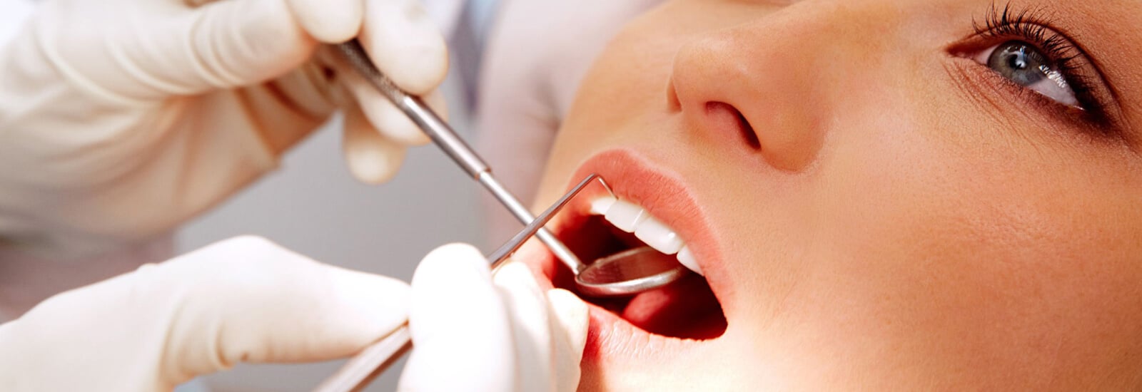 Tooth colored filling services in Thane