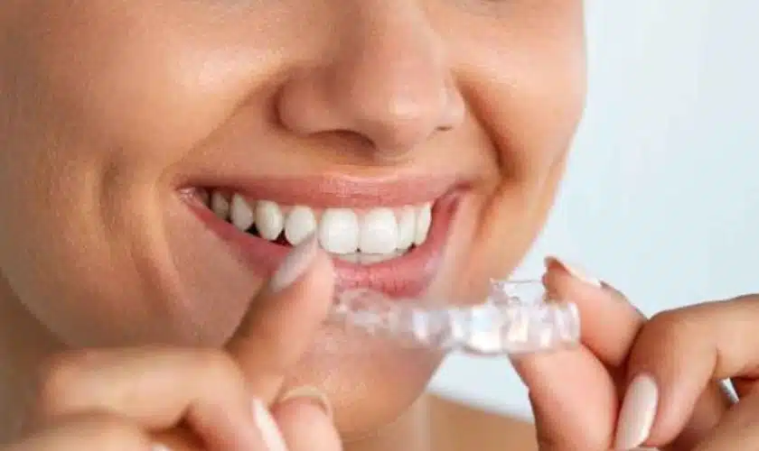 Invisalign treatment clinics in Thane