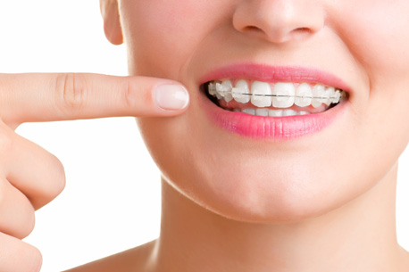 dental braces treatment in thane