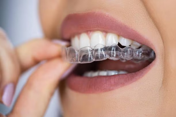 invisalign treatment clinic in Thane