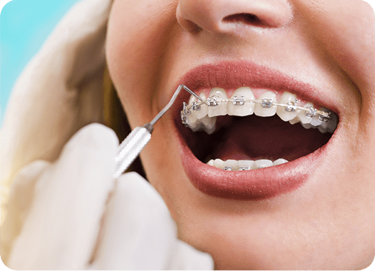 best orthodontist in Panch Pakhadi